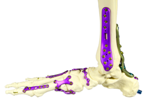 Vielseitige Fusslösungen