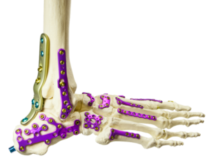 Vielseitige Fusslösungen